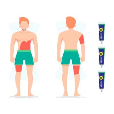 How Many Creams Do i Need? - Illustration of the areas a 3 pack of numbing cream will be able to cover. stomach, ribcage, thigh and arm sleeve in a red outline