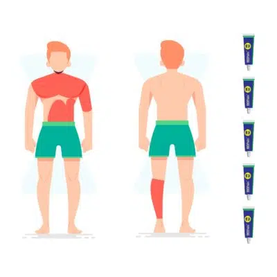 How Many Creams Do i Need? - Illustration of the areas a 5 pack of numbing cream will be able to cover. Chest, shoulder, ribcage, stomach and leg in a red outline