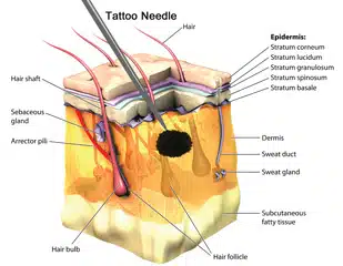 tattoo ink placed in the dermis