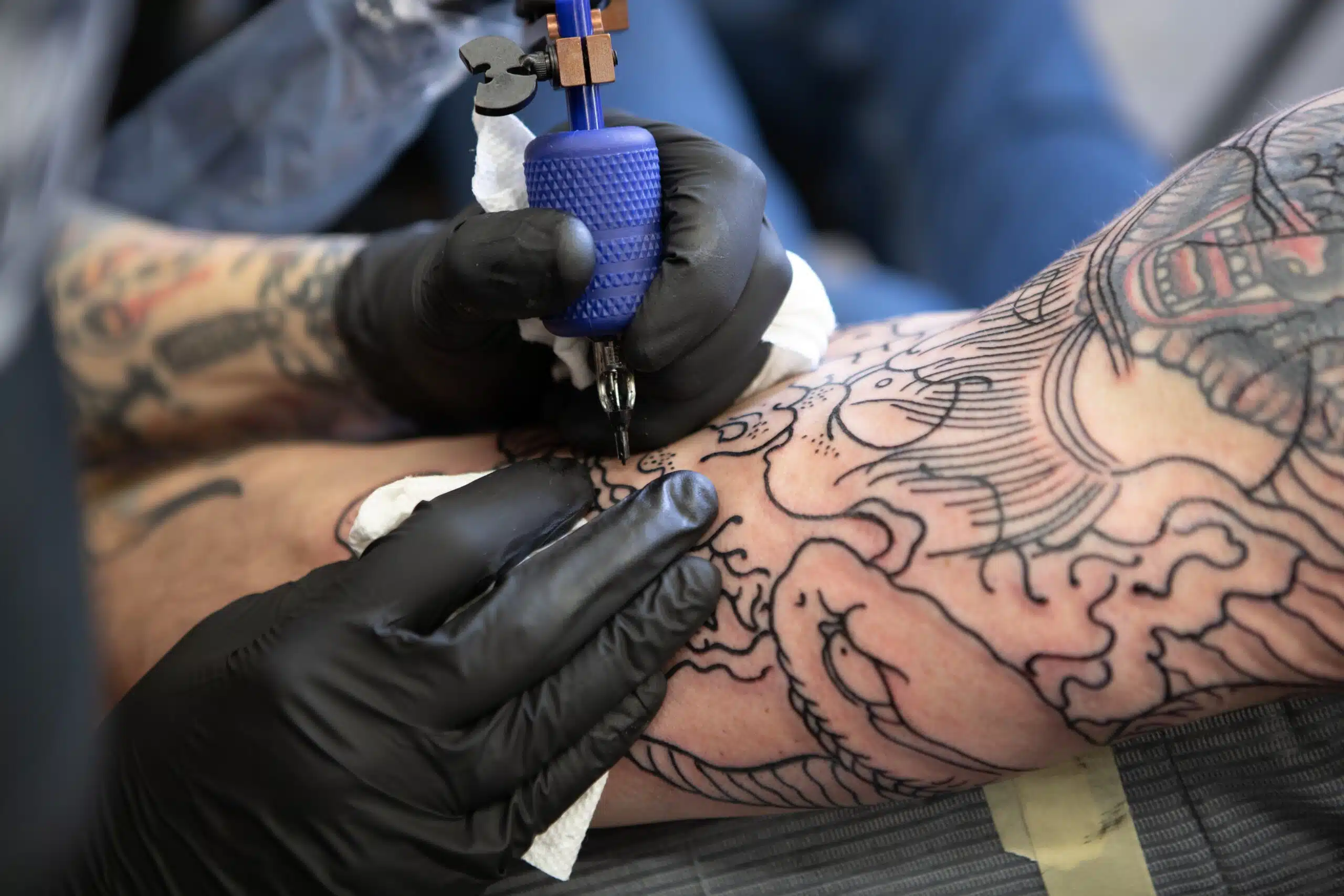 Tattoo Removal In India | AKJ Skin And Laser Centre